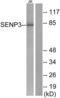SUMO Specific Peptidase 3 antibody, abx013228, Abbexa, Immunohistochemistry paraffin image 