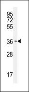 CCR4-NOT Transcription Complex Subunit 7 antibody, TA324380, Origene, Western Blot image 