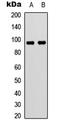 Vav Guanine Nucleotide Exchange Factor 3 antibody, LS-C368555, Lifespan Biosciences, Western Blot image 