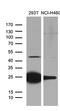 Toll Like Receptor 8 antibody, LS-C795311, Lifespan Biosciences, Western Blot image 