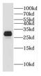 Dehydrogenase/Reductase 2 antibody, FNab02371, FineTest, Western Blot image 