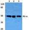 Sarcoglycan Alpha antibody, PA5-37050, Invitrogen Antibodies, Western Blot image 