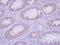 Interleukin 17C antibody, GTX117514, GeneTex, Immunohistochemistry paraffin image 