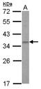 Zinc Finger Protein 501 antibody, LS-C155462, Lifespan Biosciences, Western Blot image 