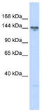 TBC1 Domain Family Member 1 antibody, TA333840, Origene, Western Blot image 