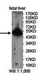 Pancreatic Lipase antibody, orb78459, Biorbyt, Western Blot image 