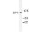 Zinc Finger E-Box Binding Homeobox 2 antibody, LS-C177339, Lifespan Biosciences, Western Blot image 