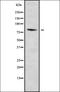 ATP Binding Cassette Subfamily B Member 8 antibody, orb338045, Biorbyt, Western Blot image 