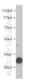 Voltage Dependent Anion Channel 3 antibody, 14451-1-AP, Proteintech Group, Western Blot image 