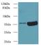 Armadillo Repeat Containing 10 antibody, LS-C379029, Lifespan Biosciences, Western Blot image 