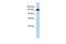 Gse1 Coiled-Coil Protein antibody, PA5-70074, Invitrogen Antibodies, Western Blot image 