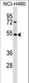 TFIIA-alpha and beta-like factor antibody, LS-C166722, Lifespan Biosciences, Western Blot image 