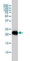 Ras Homolog Family Member A antibody, ab54835, Abcam, Western Blot image 