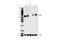 MYCN Proto-Oncogene, BHLH Transcription Factor antibody, 51705S, Cell Signaling Technology, Western Blot image 