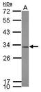 Translational Activator Of Cytochrome C Oxidase I antibody, PA5-31909, Invitrogen Antibodies, Western Blot image 