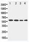 Phosphatidylcholine-sterol acyltransferase antibody, PA1967, Boster Biological Technology, Western Blot image 