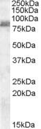 ABCC5 antibody, 45-903, ProSci, Immunohistochemistry paraffin image 