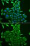 CD84 Molecule antibody, GTX32506, GeneTex, Immunofluorescence image 