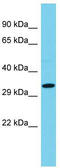 Coiled-Coil Domain Containing 42 antibody, TA340352, Origene, Western Blot image 