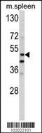 Matrix Metallopeptidase 10 antibody, 62-167, ProSci, Western Blot image 