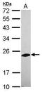 Phosphatase, Orphan 2 antibody, GTX119798, GeneTex, Western Blot image 