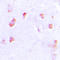 Collagen Type XX Alpha 1 Chain antibody, LS-C353504, Lifespan Biosciences, Immunohistochemistry paraffin image 