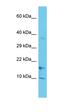 Carcinoembryonic antigen-related cell adhesion molecule 20 antibody, orb326749, Biorbyt, Western Blot image 