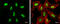 DNA Methyltransferase 3 Beta antibody, GTX129127, GeneTex, Immunofluorescence image 