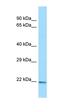 C-Type Lectin Domain Family 3 Member A antibody, orb326634, Biorbyt, Western Blot image 