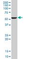 Fatty Acid Desaturase 1 antibody, H00003992-M04, Novus Biologicals, Western Blot image 