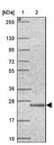 UBA Like Domain Containing 1 antibody, NBP2-38094, Novus Biologicals, Western Blot image 