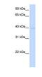 Tropomodulin 2 antibody, NBP1-79571, Novus Biologicals, Western Blot image 