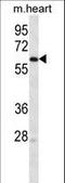 Leucine Rich Repeat And Ig Domain Containing 4 antibody, LS-C165790, Lifespan Biosciences, Western Blot image 