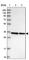 VPS37B Subunit Of ESCRT-I antibody, HPA038218, Atlas Antibodies, Western Blot image 