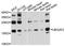 Ubiquitin Conjugating Enzyme E2 G2 antibody, A10408, ABclonal Technology, Western Blot image 