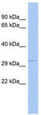 Outer Dense Fiber Of Sperm Tails 4 antibody, TA337857, Origene, Western Blot image 