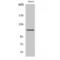 Serine/threonine-protein kinase D1 antibody, LS-C385552, Lifespan Biosciences, Western Blot image 