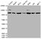 Phosphatidylinositol-4,5-Bisphosphate 3-Kinase Catalytic Subunit Alpha antibody, CSB-RA578819A0HU, Cusabio, Western Blot image 