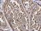 ADP Ribosylation Factor 1 antibody, PA5-22271, Invitrogen Antibodies, Immunohistochemistry paraffin image 