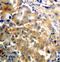 Protein Kinase C Zeta antibody, abx000480, Abbexa, Immunohistochemistry paraffin image 
