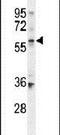 Beta-Carotene Oxygenase 1 antibody, PA5-23974, Invitrogen Antibodies, Western Blot image 