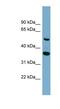 ADAM Like Decysin 1 antibody, NBP1-59146, Novus Biologicals, Western Blot image 