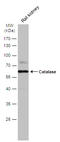 Catalase antibody, GTX110704, GeneTex, Western Blot image 