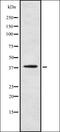 Pregnancy Up-Regulated Nonubiquitous CaM Kinase antibody, orb378248, Biorbyt, Western Blot image 