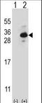 Clathrin Light Chain B antibody, LS-C168859, Lifespan Biosciences, Western Blot image 