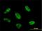 RNA Polymerase I And III Subunit C antibody, H00009533-M02, Novus Biologicals, Immunocytochemistry image 