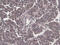 Beclin 1 antibody, abx025181, Abbexa, Immunohistochemistry paraffin image 