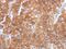 Perilipin 2 antibody, GTX34398, GeneTex, Immunohistochemistry paraffin image 