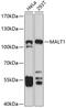 MALT1 Paracaspase antibody, GTX55695, GeneTex, Western Blot image 
