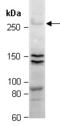 ATP Binding Cassette Subfamily A Member 1 antibody, orb66971, Biorbyt, Western Blot image 